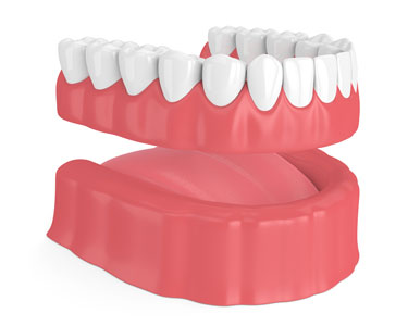 Removable Dentures