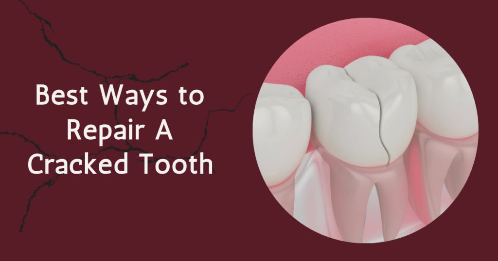 Best Ways to Repair a Cracked Tooth
